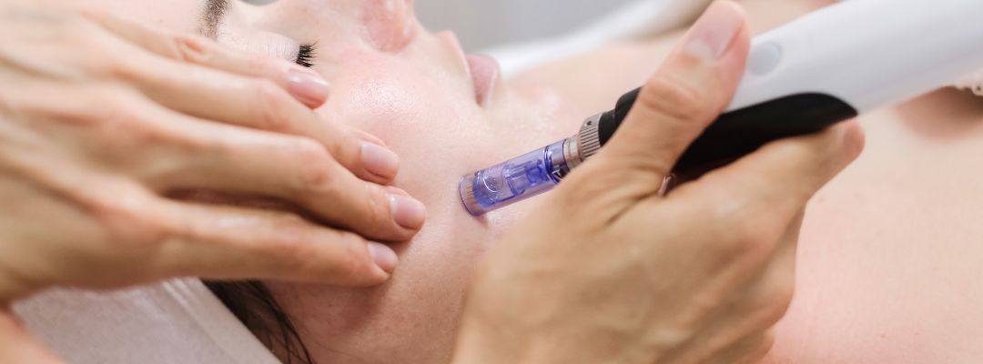 El mejor curso de dermapen en Madrid