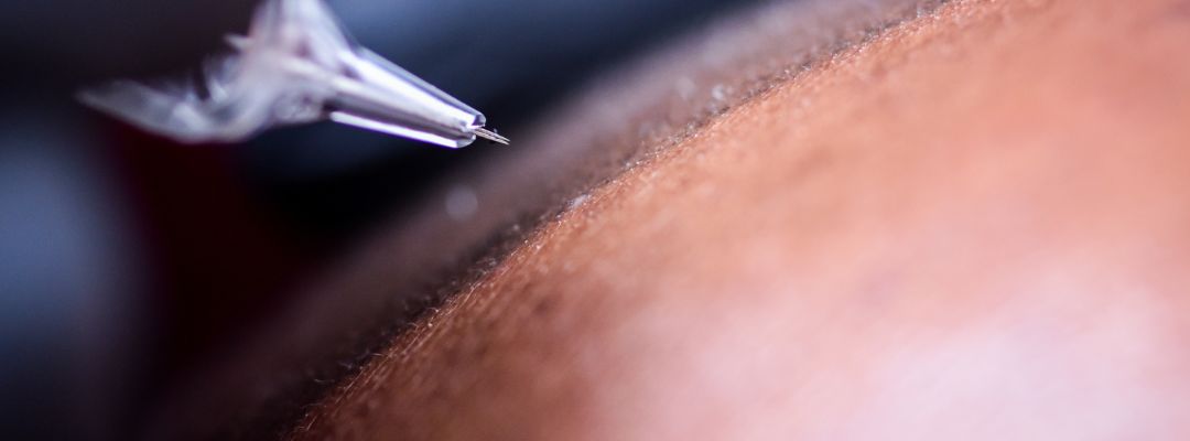 Diferencia entre micropigmentación y tricopigmentación capilar